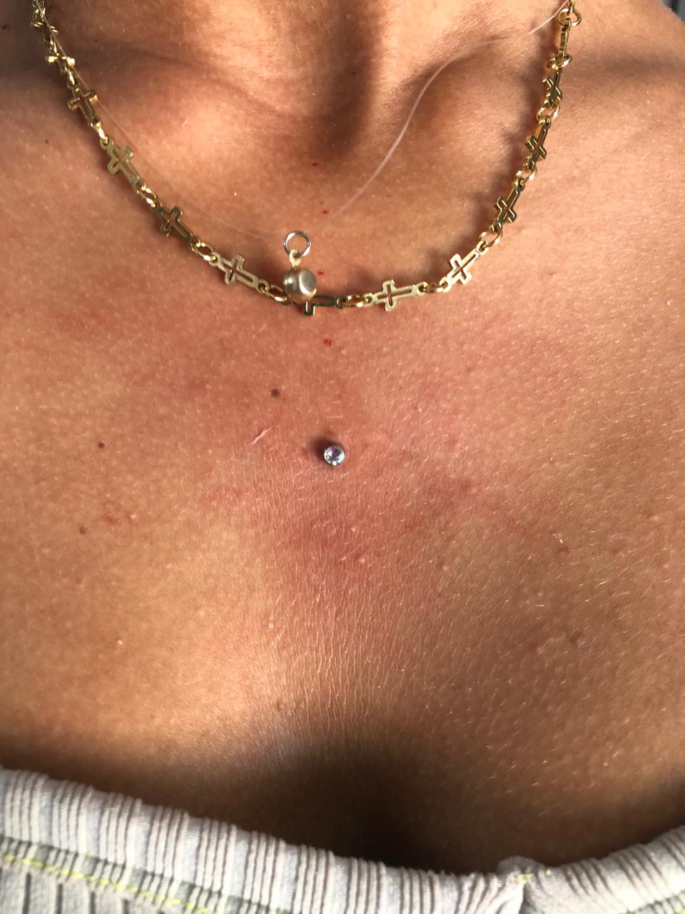 Microdermal - colo